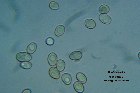 Microscopia - Onygen  equina  (1)